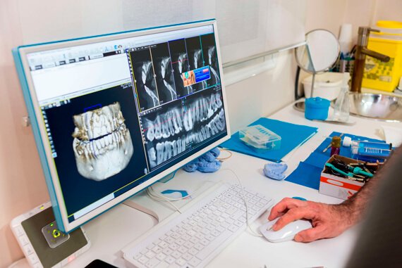 Radiologia 2D e 3D nei centri dentistici Dentamed Favetti