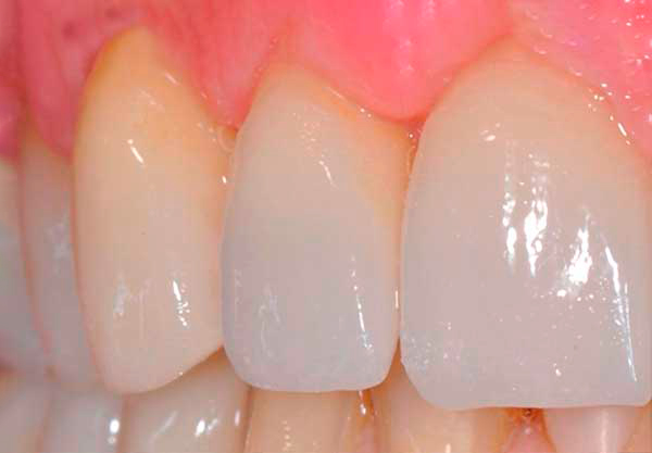 Protesi cad cam nei centri Dentamed Favetti